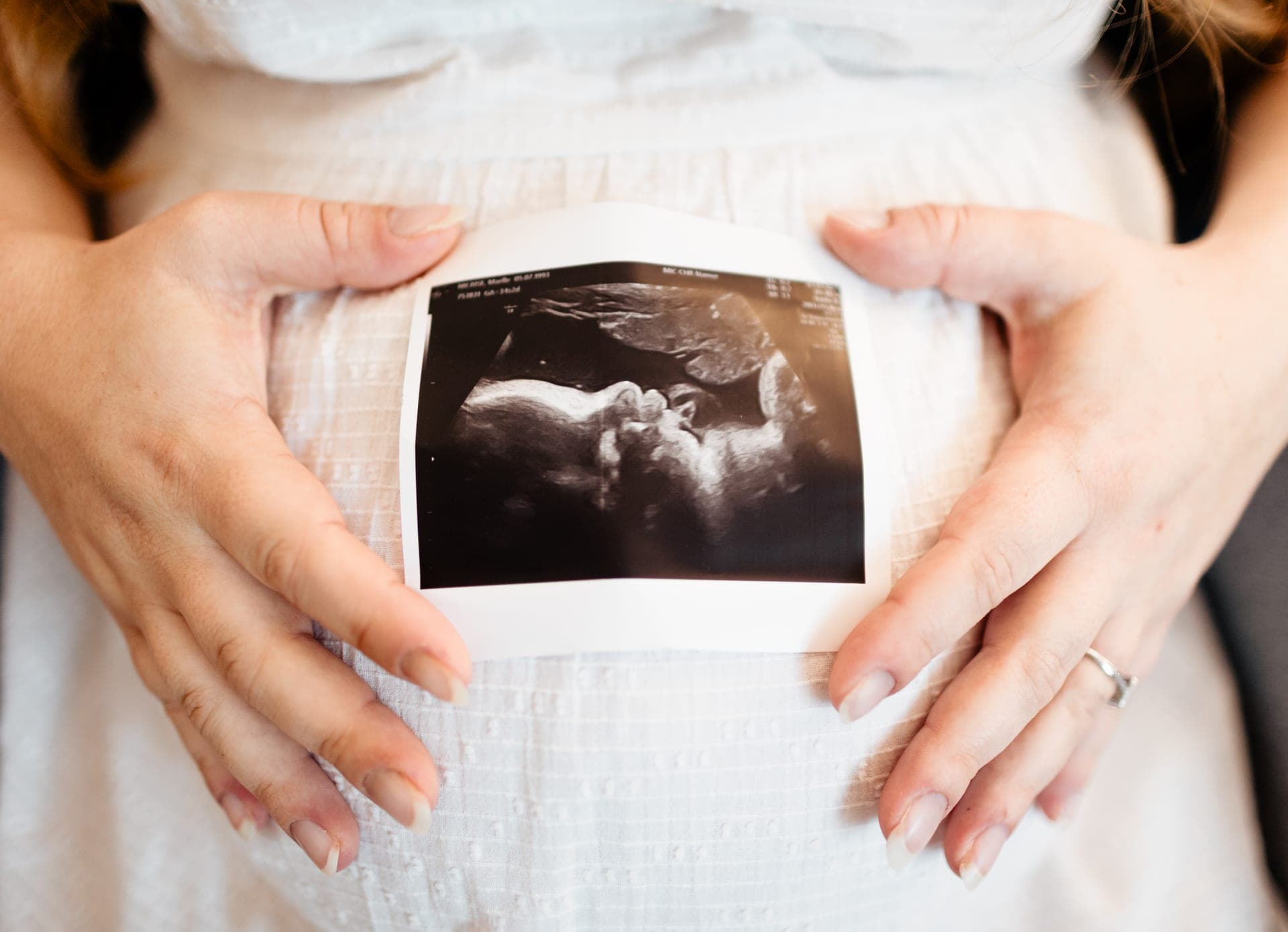 Échographie posée sur le ventre de grossesse avec mains — détail séance grossesse